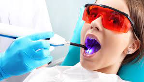Teeth Cleaning 
